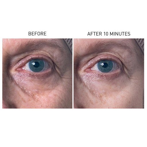 Skyn Iceland Hydro Cool Firming Eye Gels Before and After