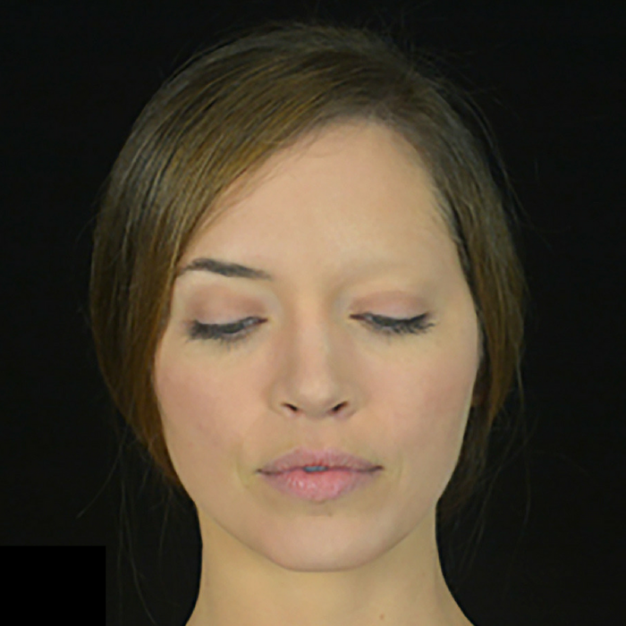 Out Of Kit Brow Blocker (Large) Light Applied
