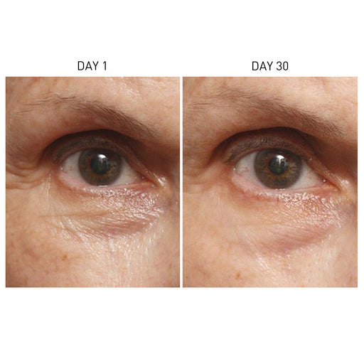 Skyn Iceland Icelandic Relief Eye Cream Before & After