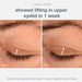 Dermalogica Phyto Nature Lifting Eye Cream lift of upper eyelid before and after