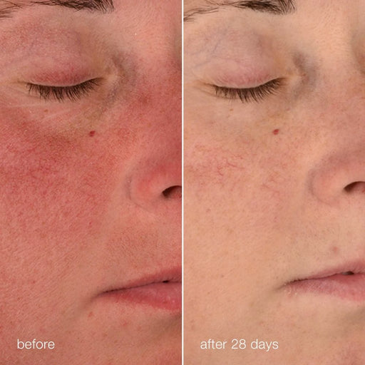 Stabilizing repair cream before and after on face