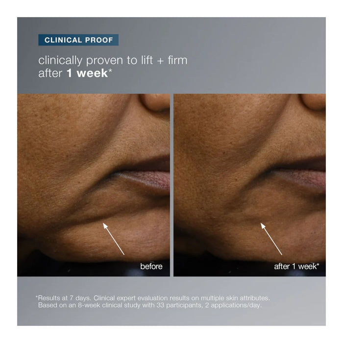 Dermalogica Futurecode Booster before and after using for 1 week side-by-side