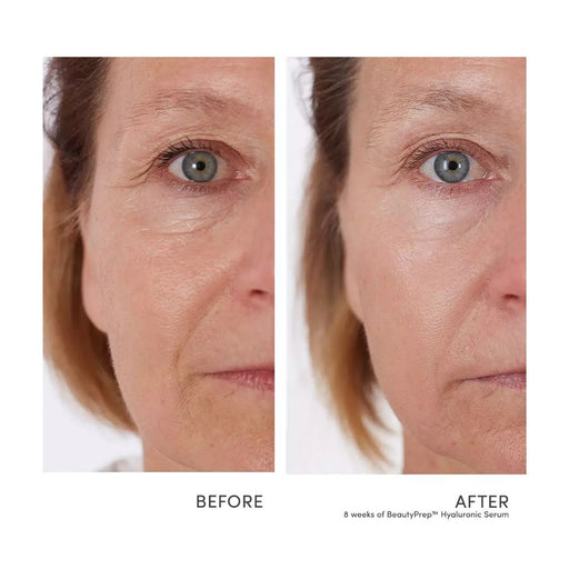 Jane Iredale BeautyPrep Hyaluronic Serum before and after side-by-side after using for 8 weeks on mature skin.