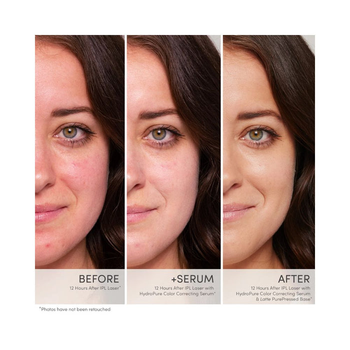 Jane Iredale HydroPure Color Correcting Serum Redness Corrector Before and Afters