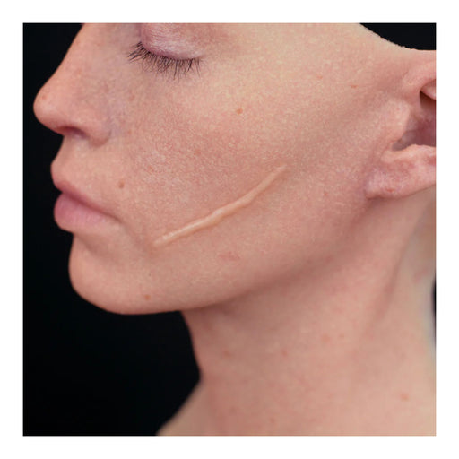 Out of Kit Single Scar (Medium) applied to the hollow of cheek