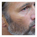 Out of Kit Sunken Scar 2 applied to male cheekbone