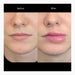 Out of Kit Swollen Lips 2 before and after finished application side-by-side