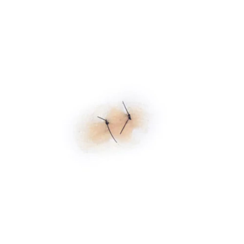 Out of Kit Sutured Wound 2 Stitch — Frends Beauty