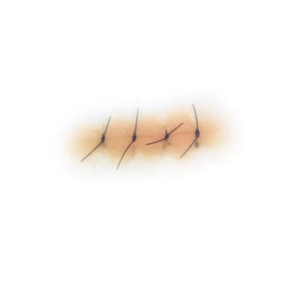 Out of Kit Sutured Wound 4 Stitch — Frends Beauty