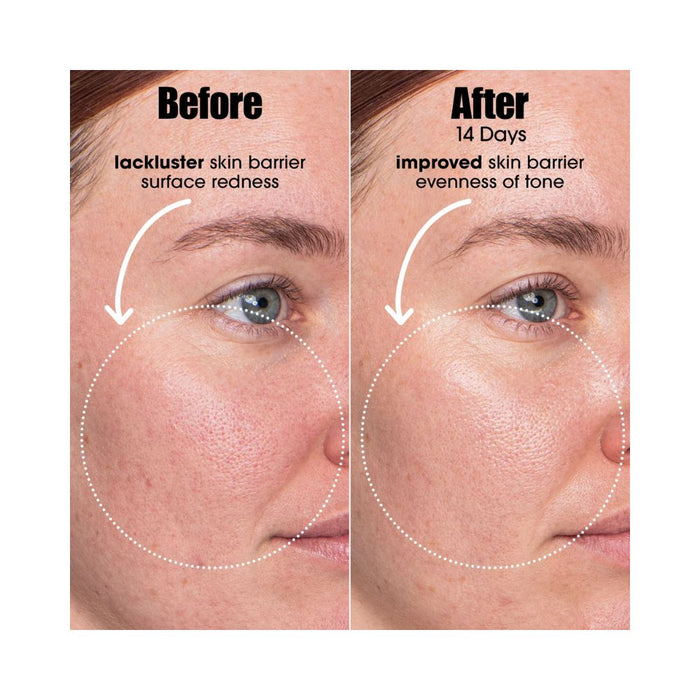 Sunday Riley AI Smart Retinoid Serum before and after on female after 2 weeks of use