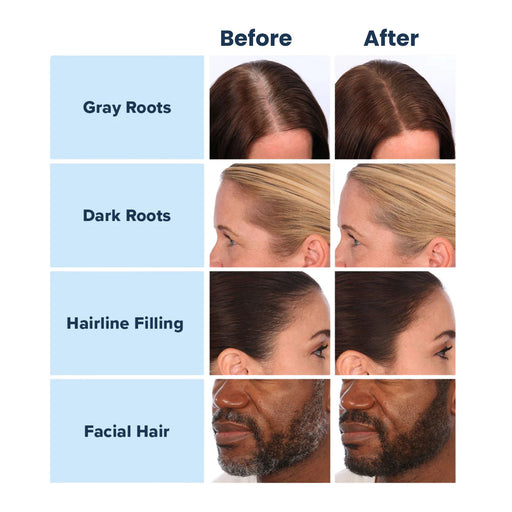 Truhair Color & Conceal before and after examples of different applications