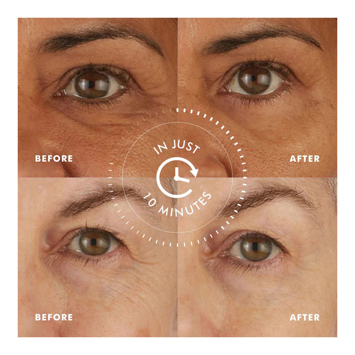 Skyn Iceland Hydro Cool Firming Eye Gels before and after 10 minutes results side-by-side